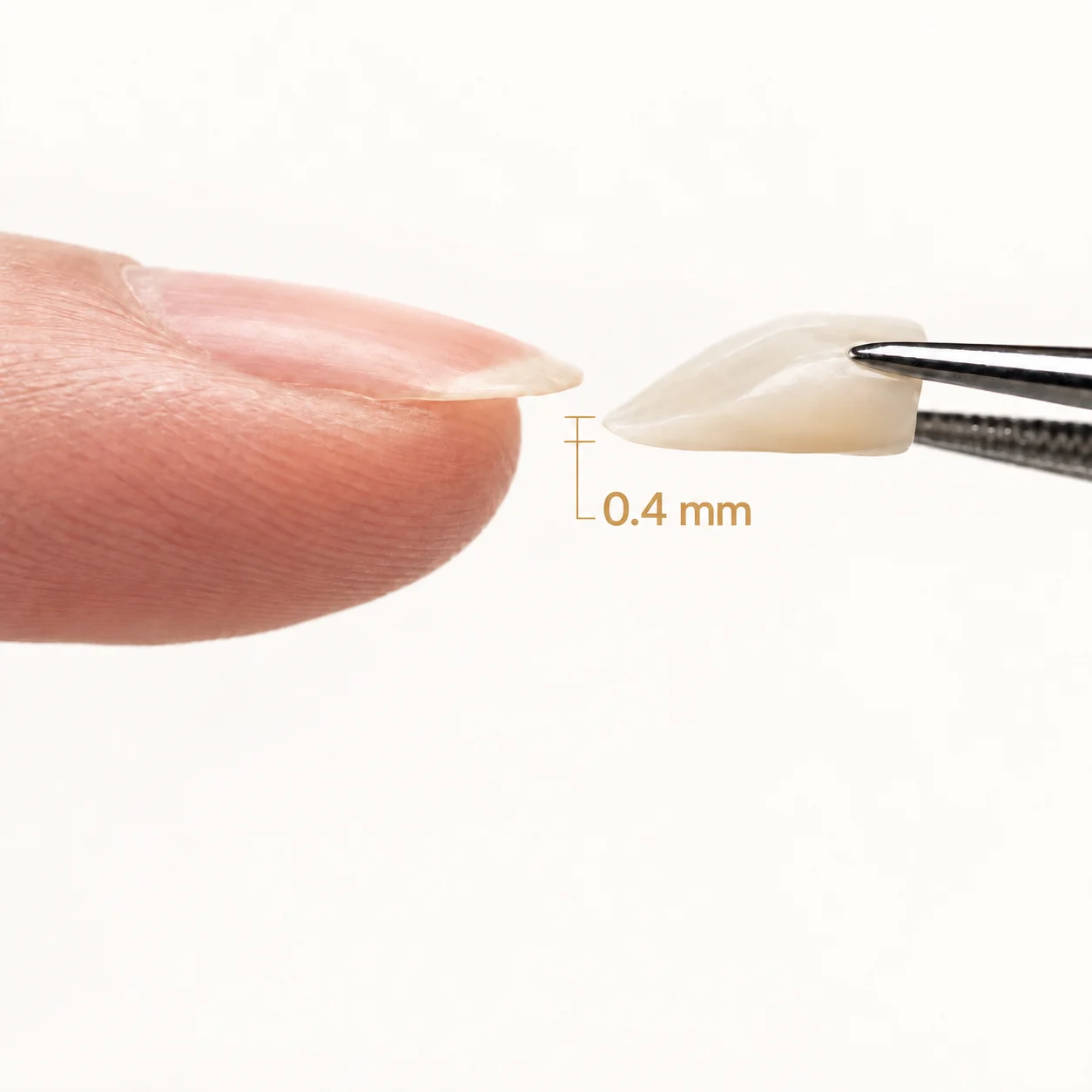 Ultra-Thin Crowns in Turkey: How Can Something So Thin Be So Strong?
